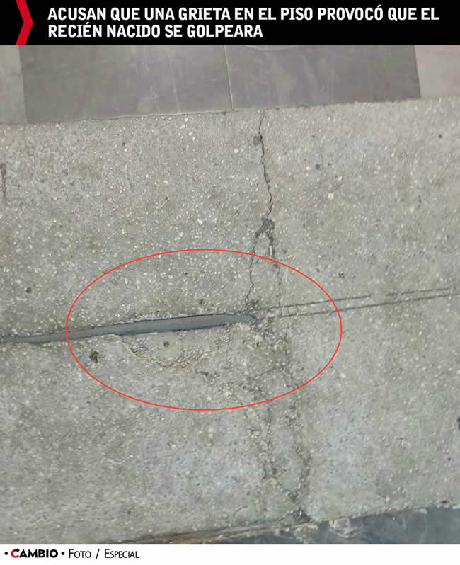 grieta imss la margarita caida bebe recien nacido