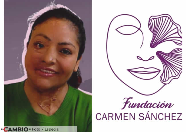 fundacion carmen sanchez mujeres atacadas acido