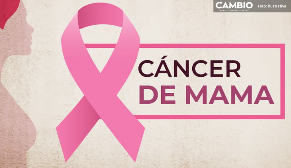122 mujeres han muerto por cáncer de mama en Puebla este 2021, revela SSA
