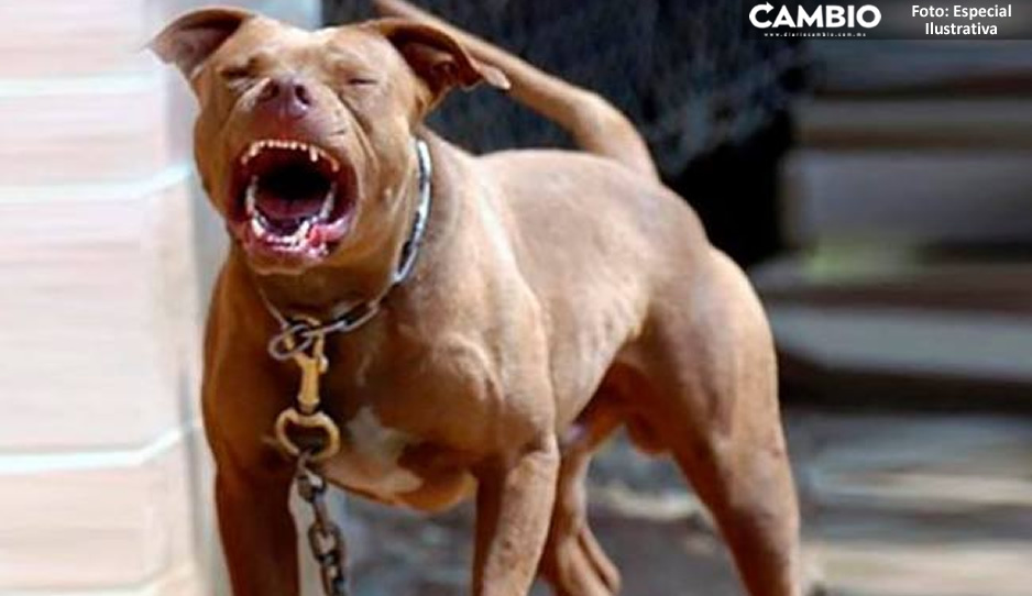 Mujer ve como un pitbull persigue a su hijo de 5 años, se impresiona y muere de un infarto
