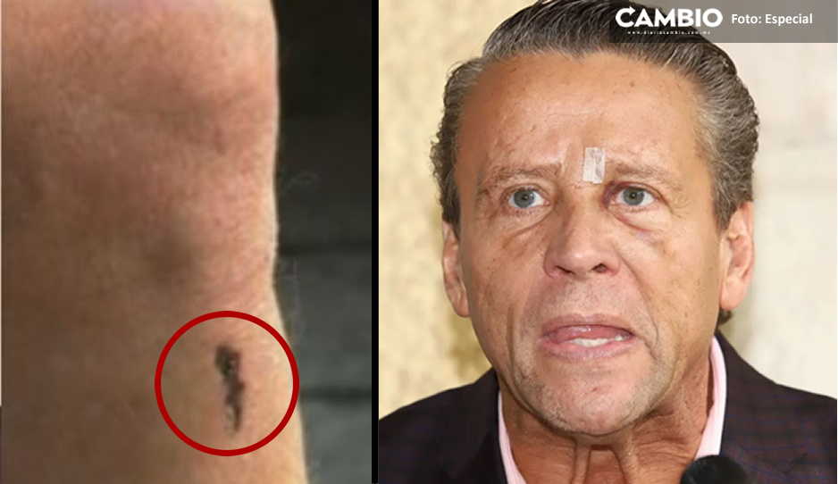 Alfredo Adame muestra sus heridas “graves” tras pelea callejera: “me querían matar” (VIDEO)