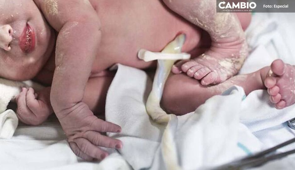 ¡Increíble! Nace primer bebé con anticuerpos de Covid-19  