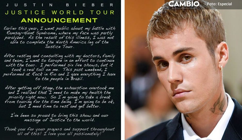 ¡Oh, no! Justin Bieber cancela su gira mundial por su mal estado de salud