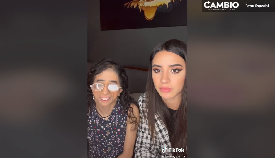 ¡Entre enojo y tristeza! Tiktoker narra discriminación por su condición física en un restaurante (VIDEO)