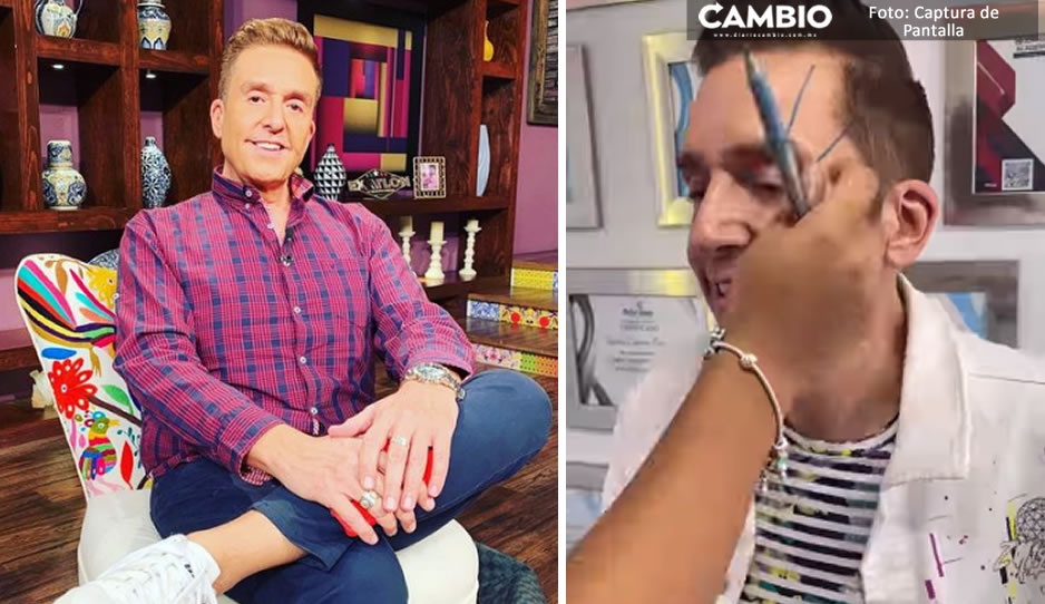 ¡La belleza duele! Daniel Bisogno se somete a rejuvenecimiento facial y así quedó (VIDEO)