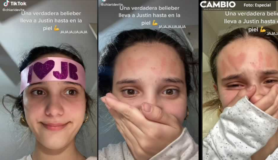 VIDEO: Fan de Justin Bieber se pone cinta y se le queda pintada en la frente