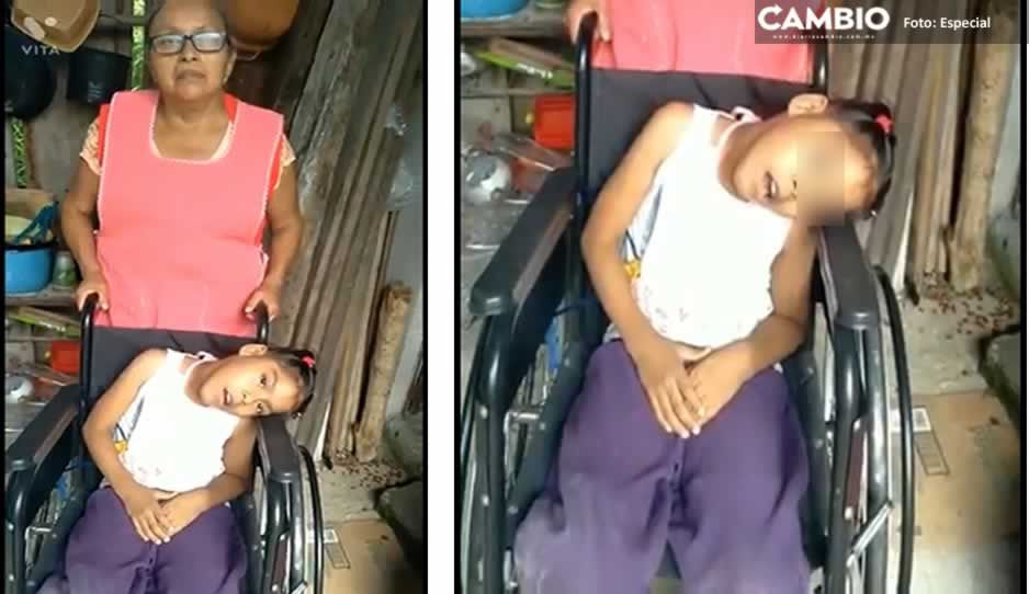 La pequeña Karely tiene discapacidad y necesita apoyo para gastos médicos ¡Ayúdala!