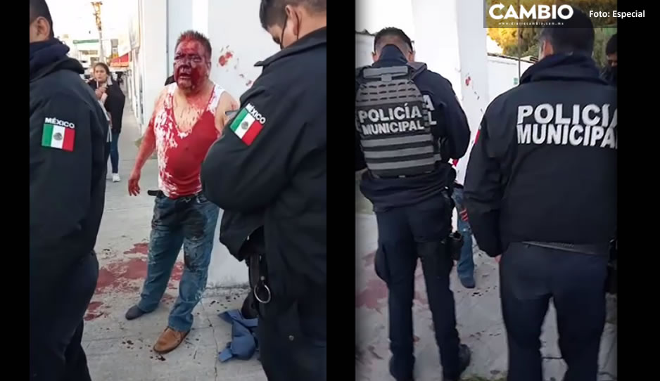 FUETE VIDEO: Así quedó el presunto ladrón de ruta Azteca tras balear a pasajero