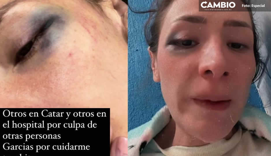 Cuñada de Yuya denuncia haber sido golpeada y retenida en un hospital (VIDEO)