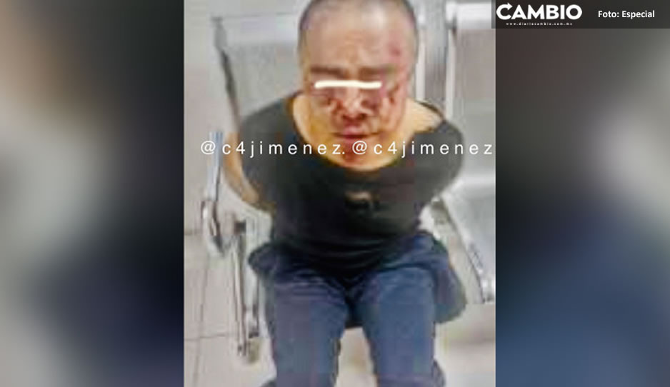 Le destrozan el rostro a golpes, por intentar asaltar a tres mujeres