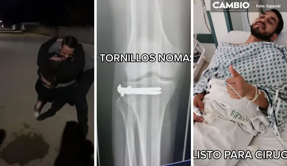 No le salió la &#039;quebradita&#039;; hombre se fractura la rodilla bailando y termina en cirugía (VIDEO)