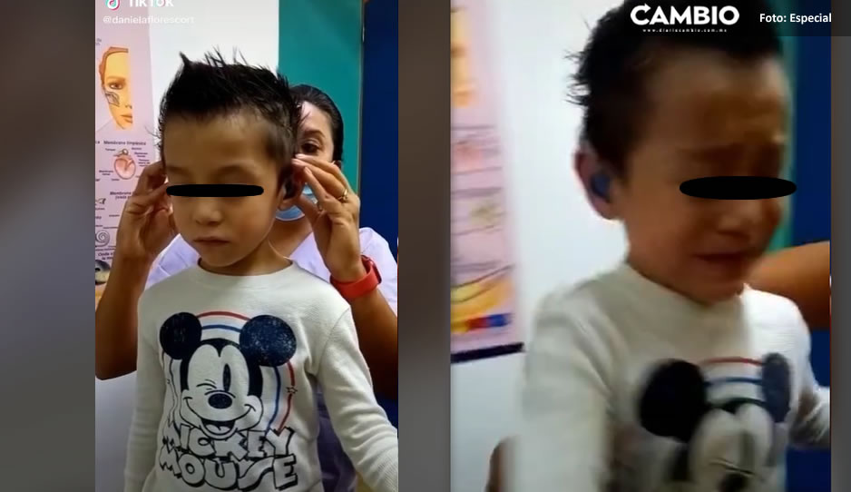 VIDEO: Niñito llora de emoción al escuchar por primera vez con aparatos auditivos
