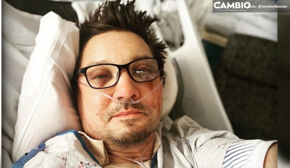 Estoy hecho un desastre: Jeremy Renner comparte foto desde el hospital