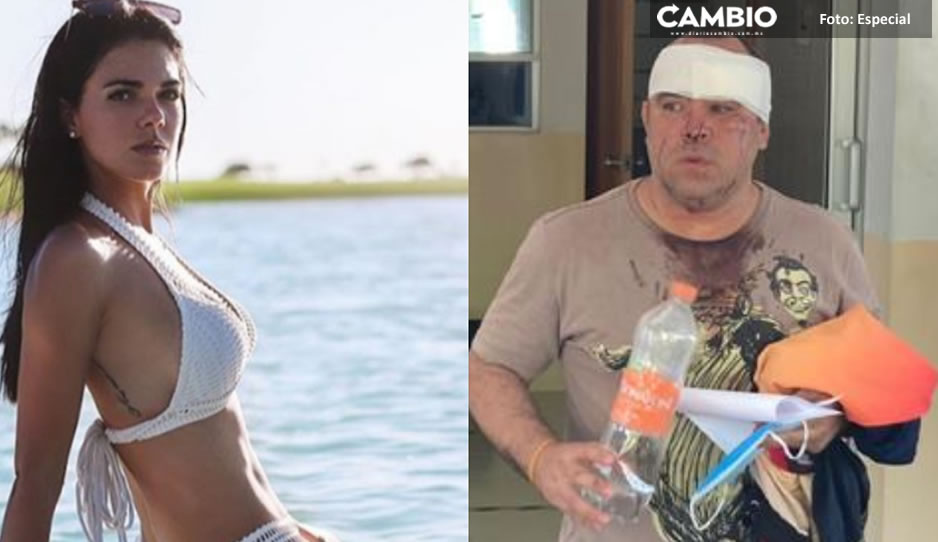 Termina demanda de Livia Brito con fotógrafo, por violencia y robo