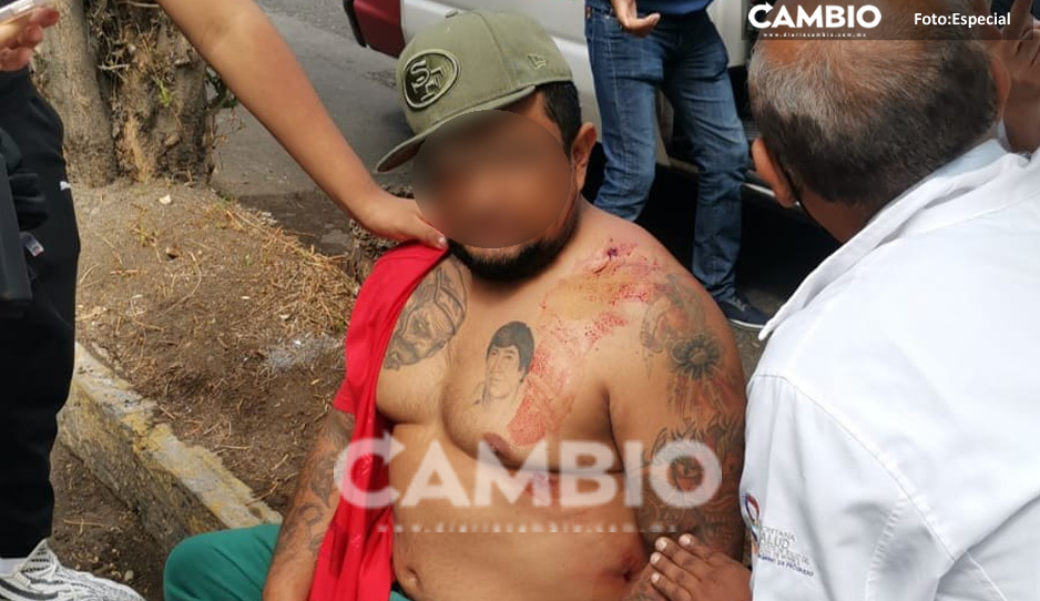 La Zorra se encuentra hospitalizado y asegurado por las autoridades
