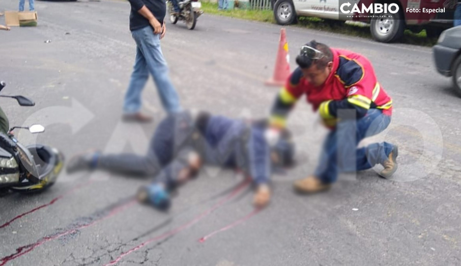 Tráiler le arranca el brazo a motociclista y muere en Zacapoaxtla (FUERTES FOTOS)