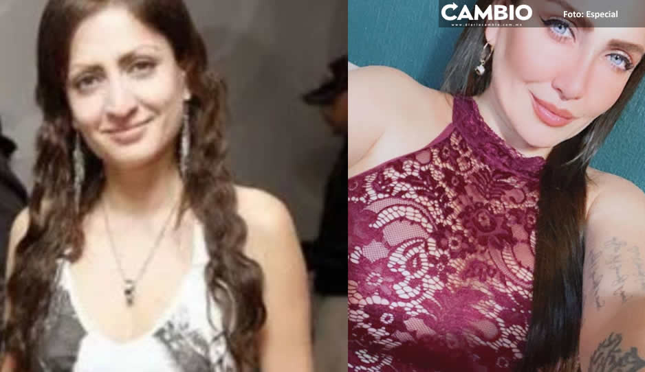 FOTOS: Así lucía Celia Lora antes y después de las cirugías