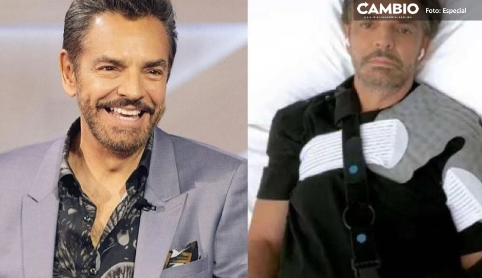 Eugenio Derbez sorprende a sus seguidores; reaparece en redes durante sesión de fisioterapia