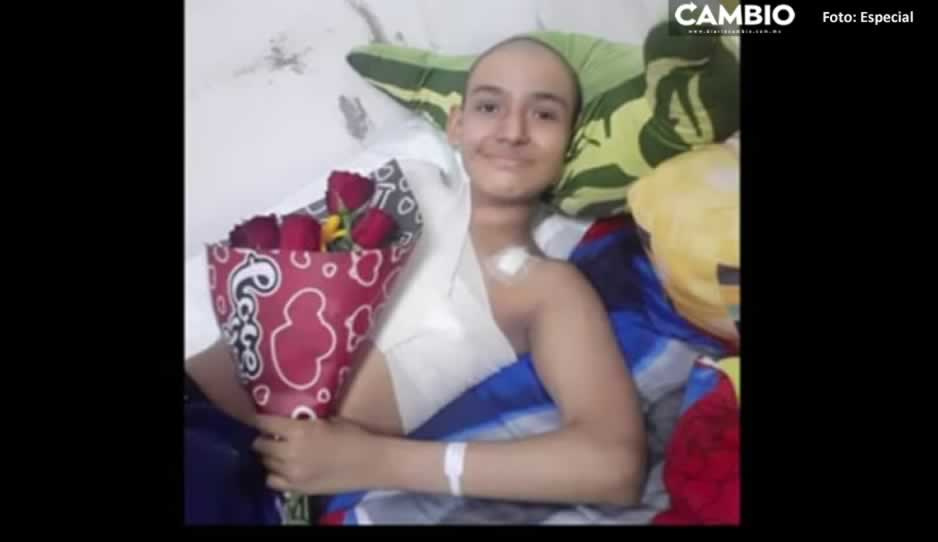 Marcos Ángel, pide apoyo para vencer el cáncer en Atlixco