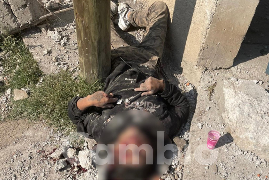 FUERTES FOTOS: Con los ojos reventados y desfigurado de la cara, así hallaron a muerto durante la explosión en Xochimehuacán