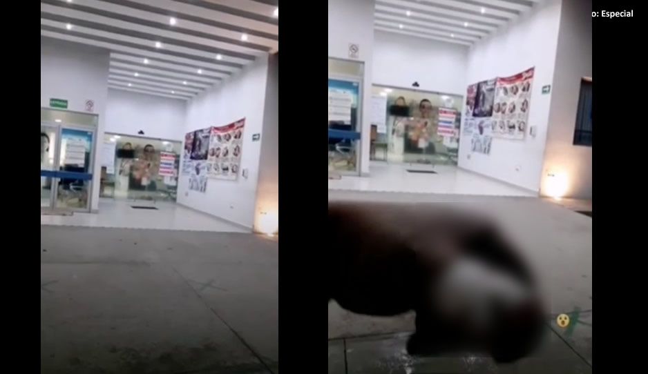 CESSA de Tochtepec niega atención a hombre con hemorragia; se amputó un dedo en su trabajo (VIDEO)