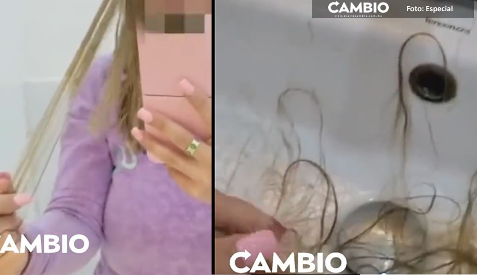 Me qued&oacute; el cabello chiquitito, me lo toc&oacute; y se me cae, narra poblana v&iacute;ctima de Studio S de Huexotitla (VIDEO)