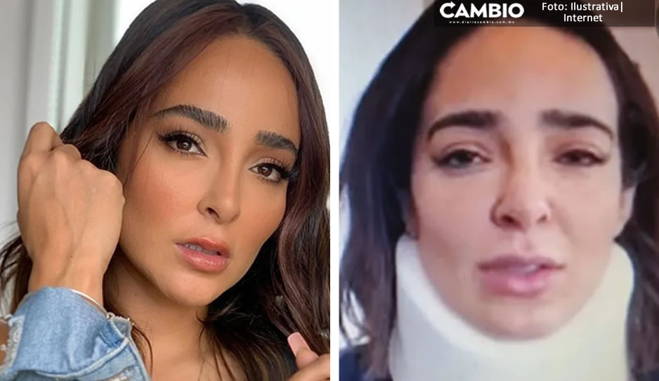Reaparece Manelyk tras brutal caída en ‘Hoy’: tengo contusión cerebral (VIDEO)