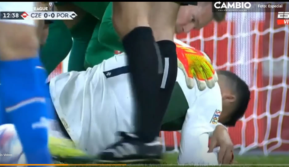 VIDEO: Así fue el golpe que dejó sangrando a Cristiano Ronaldo en el Portugal vs República Checa