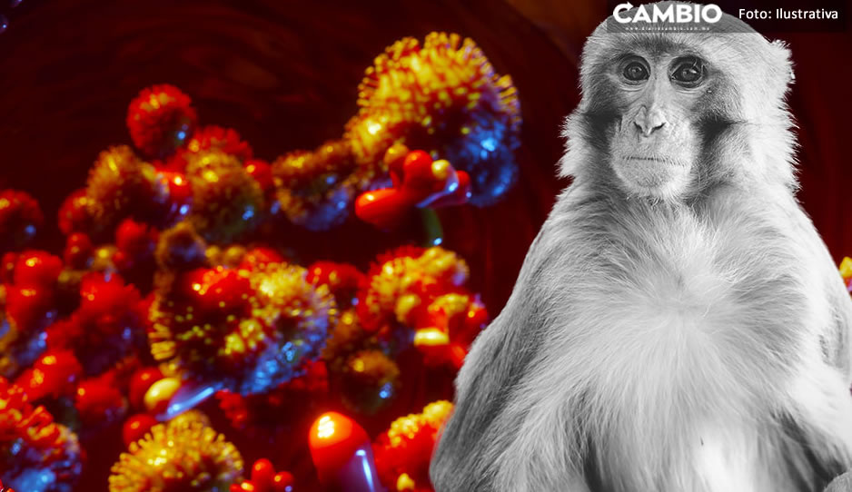 ¿Sospecha de contagio? Estos son los síntomas de la Viruela del Mono