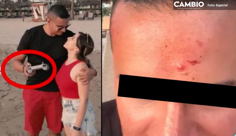 Ser romántico no es lo suyo: se estrella dron en la cara mientras grababa TikTok con su pareja en la playa