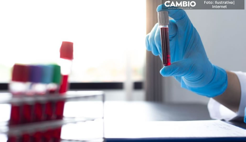 ¡Qué llegue pronto a México! Autorizan en Japón prueba de sangre para detectar Alzheimer