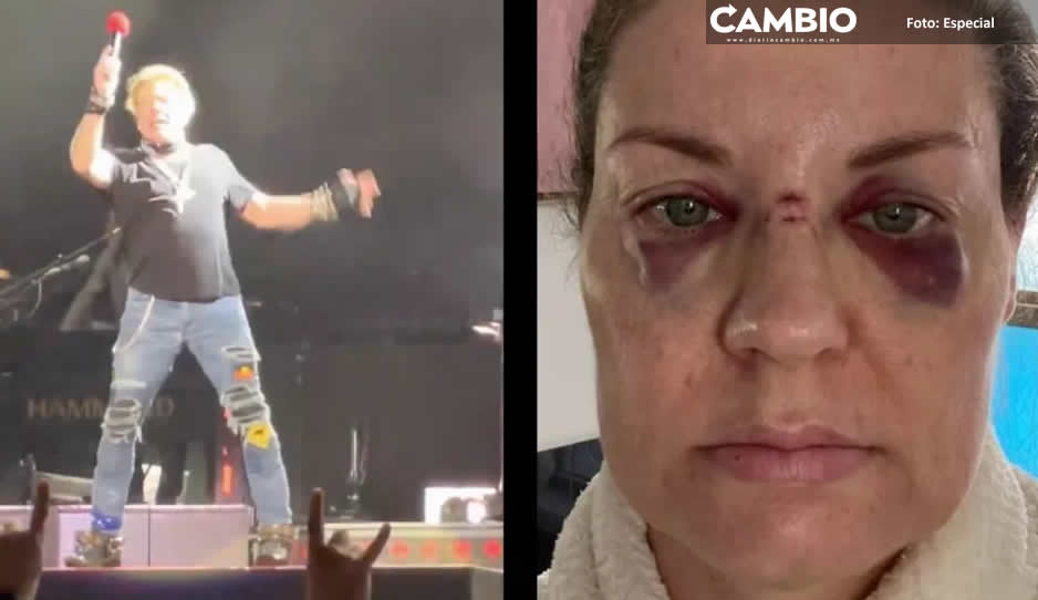Axl Rose, de Guns N’ Roses, golpea en el rostro a una fan durante un concierto