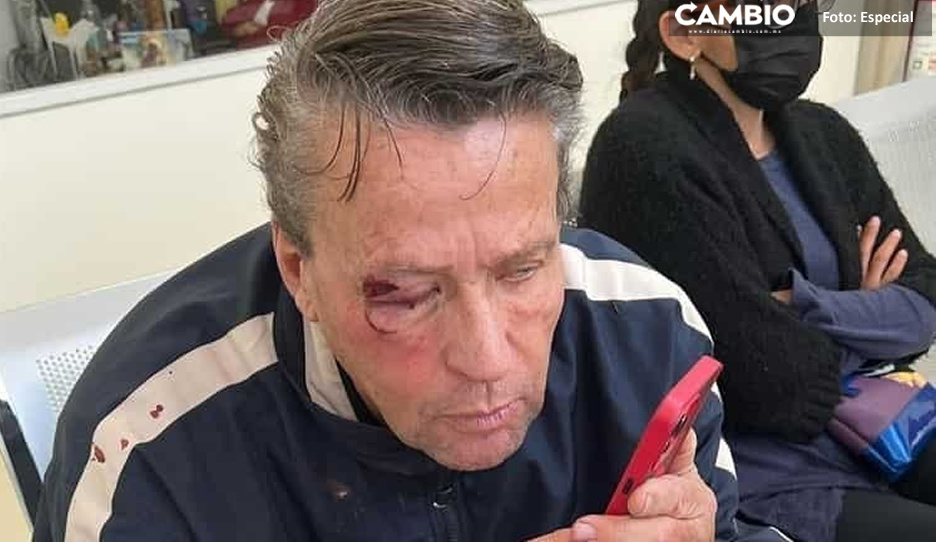 FUERTE FOTO: Alfredo Adame recibe tremenda golpiza por intentar grabar un homicidio