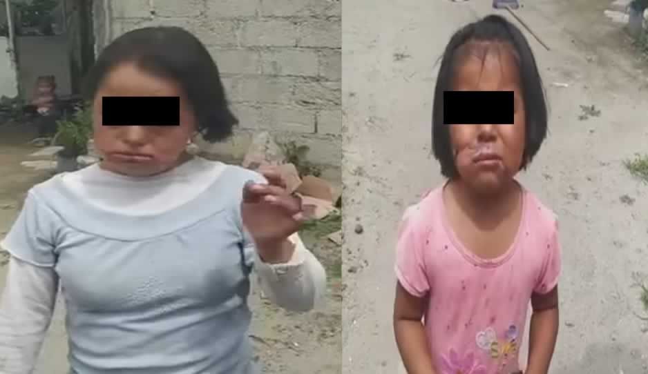 Familia desalmada golpea y quema rostro a niña y menor con síndrome de down en Tecamachalco