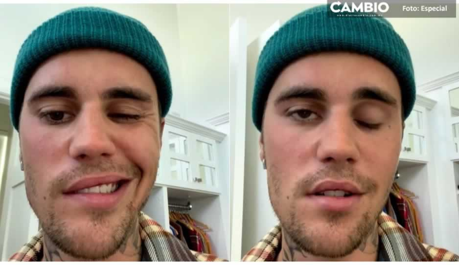 ¡Ay no! Justin Bieber anuncia que tiene paralizada la mitad de la cara (VIDEO)