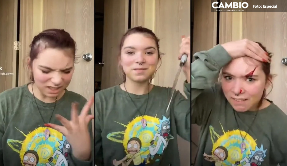 “Chop, chop, slider”: Adolescente hace peligroso reto en TikTok y termina herida (VIDEO)