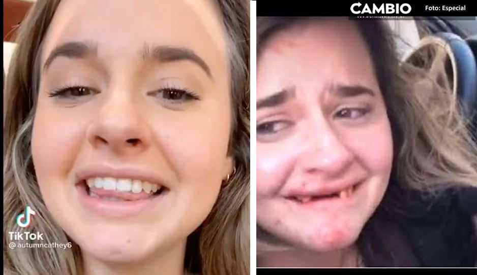 VIDEO: Joven ebria pierde los dientes cuando grababa reto en TikTok