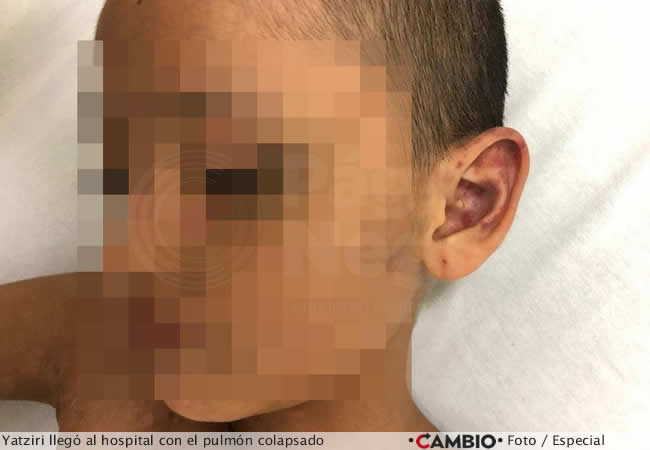 ninias victimas violencia familiar puebla yatziri