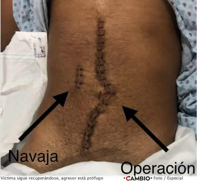 salomon n alumno udal agresion santiago zayas heridas