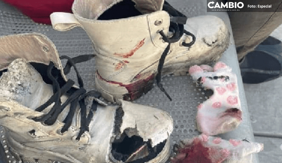Explosión de cohetón deja dos hermanitas con quemaduras en el rostro y piernas en Acajete
