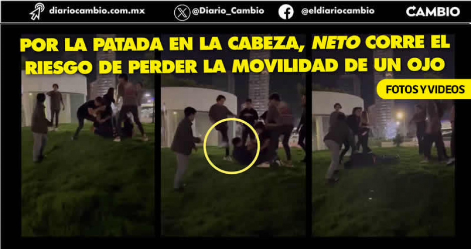Bola de siete juniors envalentonados propinan golpiza a Neto Calderón y lo mandan al hospital