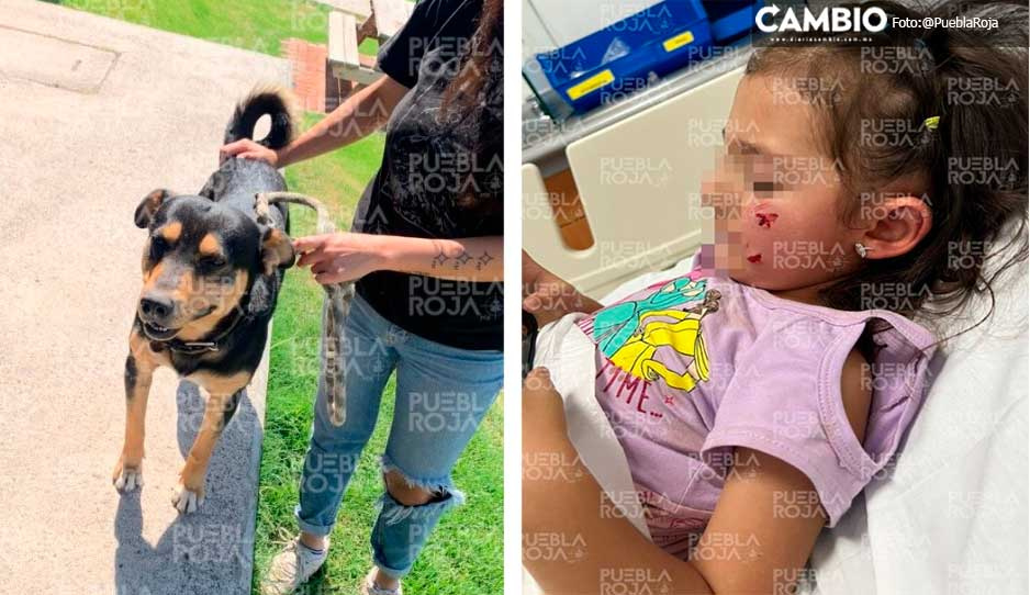Perro ataca y muerde en la cara a niñita de 4 años en restaurante de Cholula