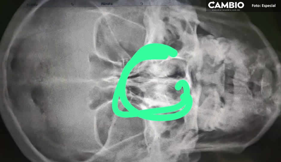 Co-fundadora de CEDE denuncia a su ex pareja por haberla violentado física y emocionalmente