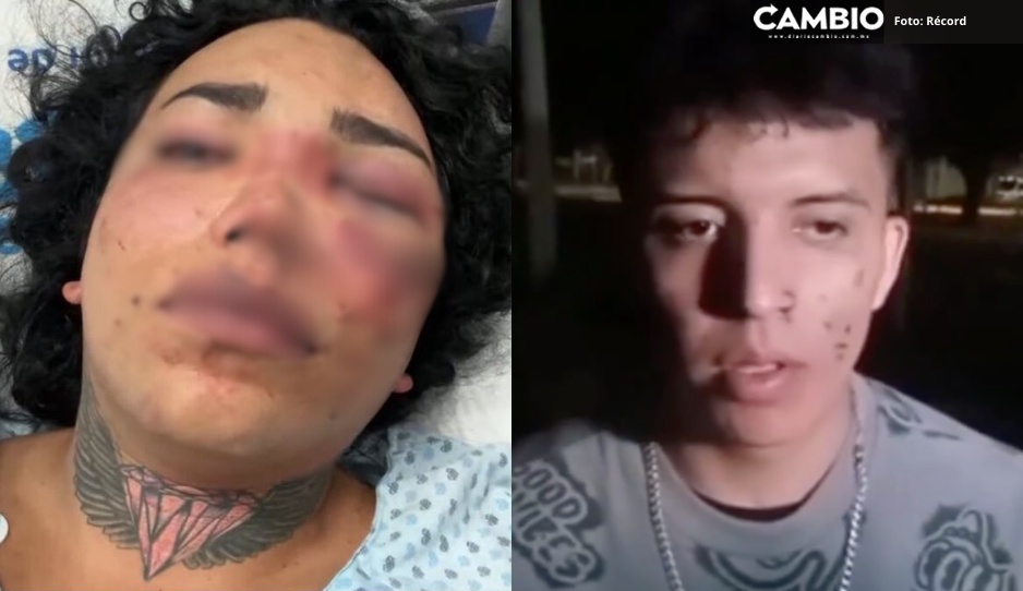 Yo no la lastimé, ella se pegó con la lámpara, asegura novio de Paola Suárez (VIDEO)