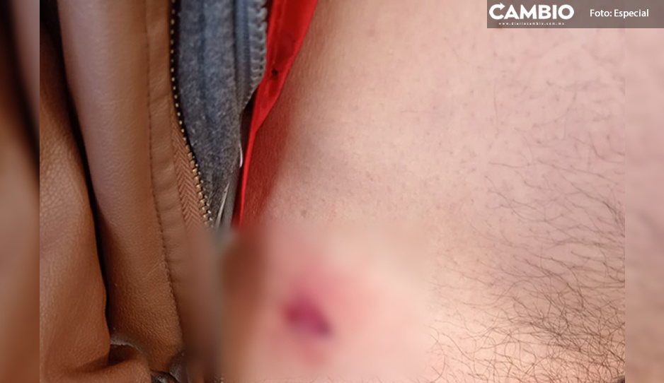 Motociclista escapa de sus asaltantes, pero termina baleado en Texmelucan