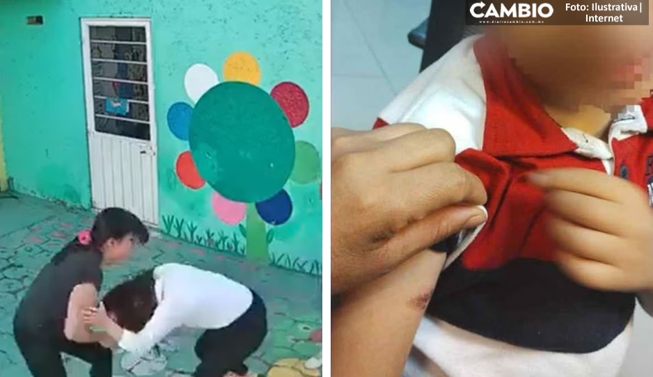 Abuelo exhibe herida del menor que provocó la agresión a la maestra del kínder en Cuautitlán