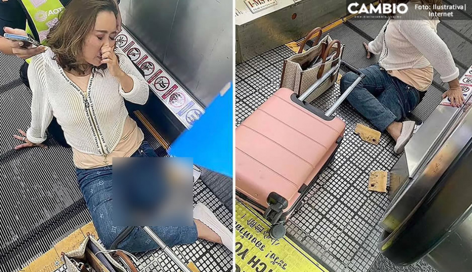 Kobieta straciła nogę po tym, jak utknęła na schodach lotniska (zdjęcie wrażliwe)