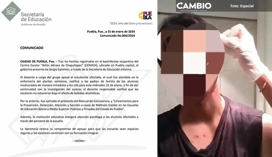 Compañeros golpean brutalmente a alumno del CENHCH
