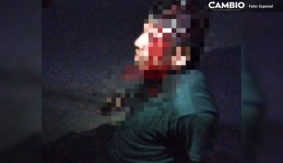 ¡Qué violento! Atacan a machetazos a joven en Tenango de las Flores  