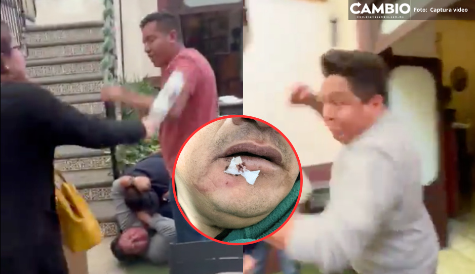 Reportero también fue golpeado por dueños de “Según la Leyenda” en Cholula (VIDEO)